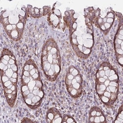 DCHS1 Antibody, Novus Biologicals:Antibodies:Primary Antibodies